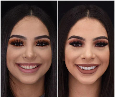 Snap On Veneers for Upper and Lower Teeth, Cosmetic Veneers with Custom Fit – image 7