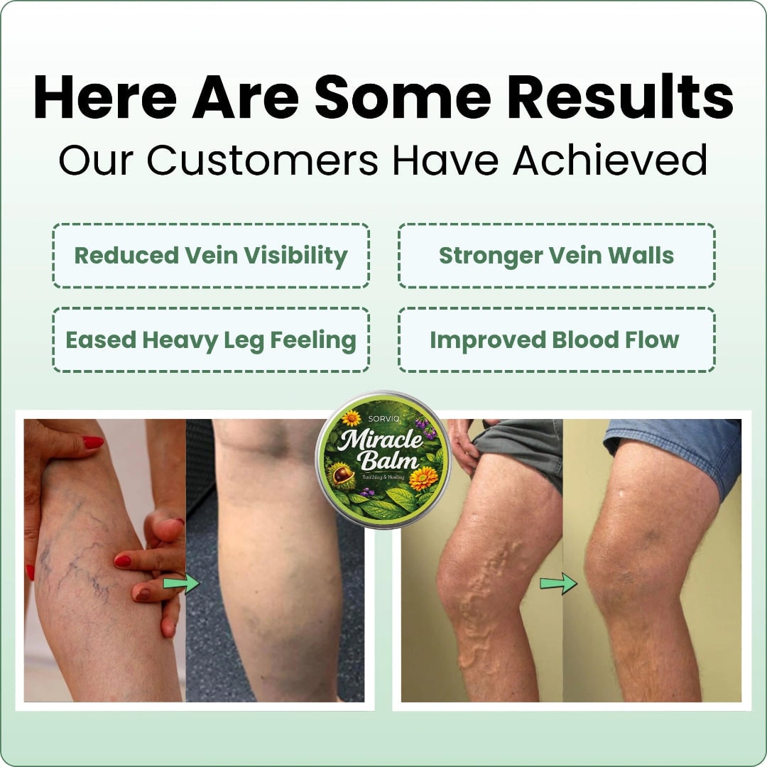 Horse Chestnut Balm, Spider Vein Cream – image 5