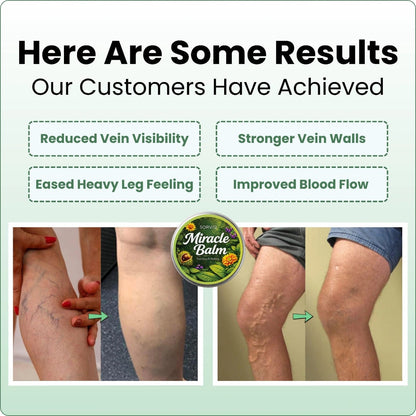 Horse Chestnut Balm, Spider Vein Cream – image 5